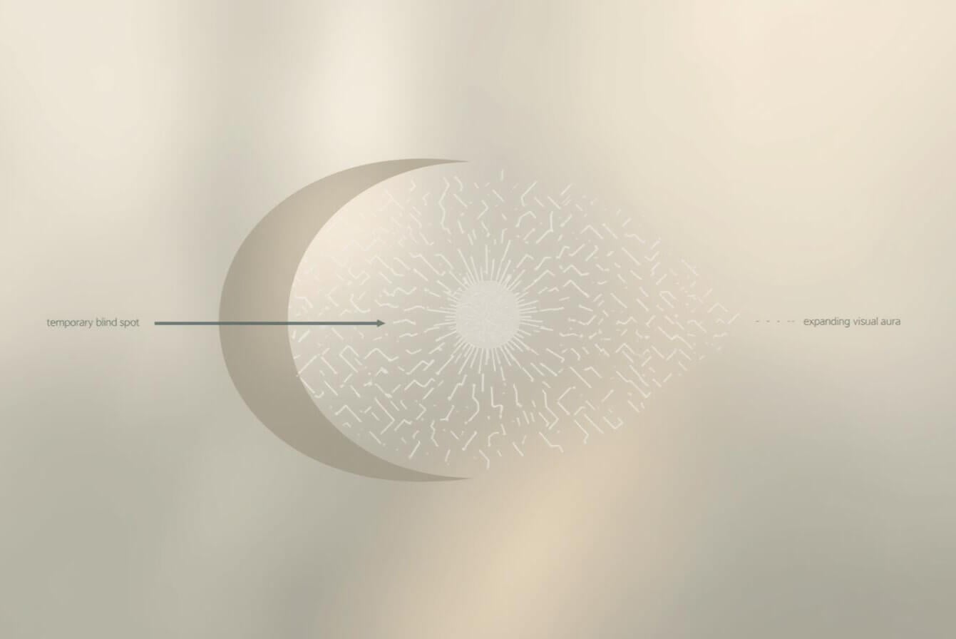 Common visual patterns seen during Migraine Aura
