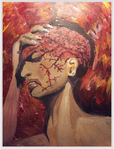 The Missing Link: Metabolism & Migraine