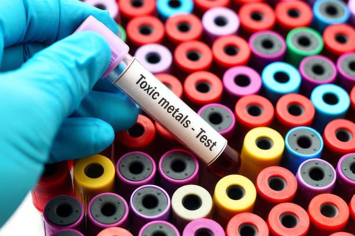 Blood sample labeled toxic metals test highlighting risks linked to migraines