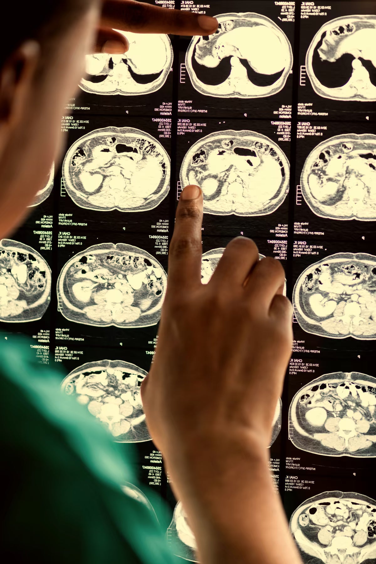 Clinician reviewing medical scans
